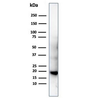 Recombinant Poly His Antibody / His Tag