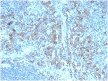 CD5 Ligand Antibody / CD5L