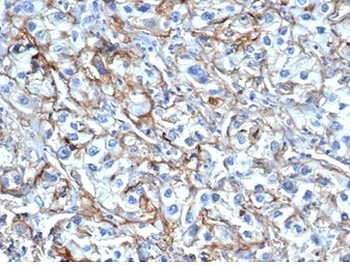 ICAM1 Antibody / CD54