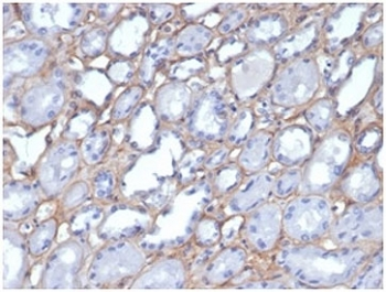 Collagen IV Antibody / COL4A1/2