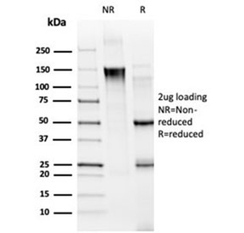 MED21 Antibody / SRB7