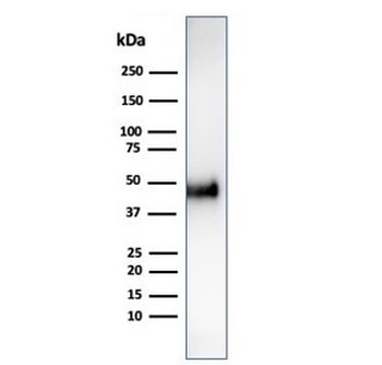 Recombinant CCNE1 Antibody / Cyclin E1