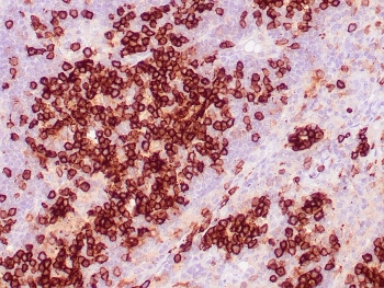 CD38 Antibody