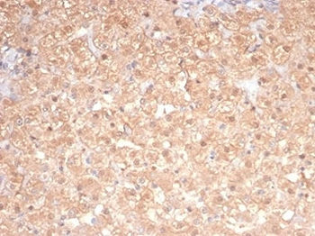 PRKCI Antibody / PKC iota