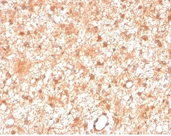 PRKCI Antibody / PKC iota