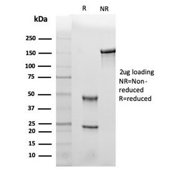 Leptin Receptor Antibody / LEPR / Ob-R