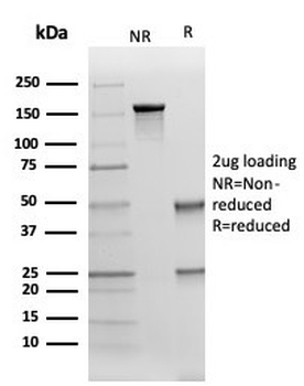 Cytokeratin 17 Antibody / CK17 / Keratin 17