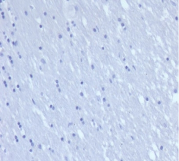 Recombinant CD7 Antibody