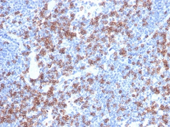 Recombinant CD8A Antibody