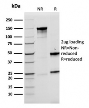 Recombinant LMO2 Antibody / Rhombotin 2