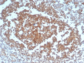 Recombinant CD40 Antibody