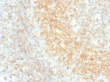 Recombinant CD40 Antibody