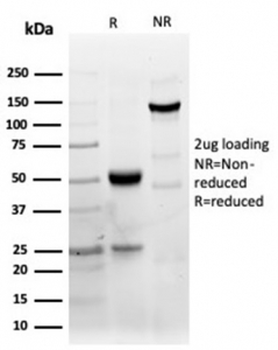 Recombinant CD40 Antibody