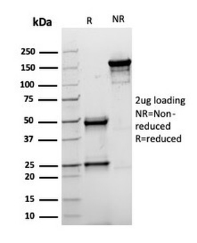 Recombinant Topoisomerase II alpha Antibody / TOP2A