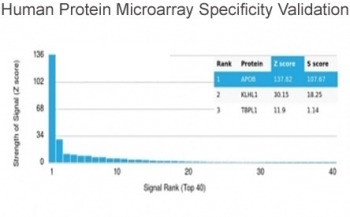 APOB Antibody / Apolipoprotein B