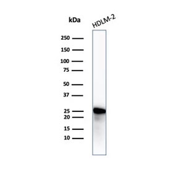 Recombinant Bcl-2 Antibody