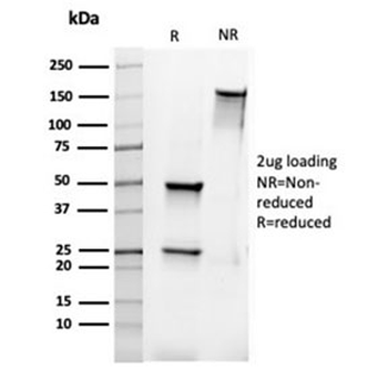 Recombinant Bcl-2 Antibody