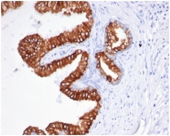 Recombinant EpCAM Antibody