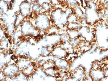 Recombinant Wilms Tumor 1 Antibody / WT1