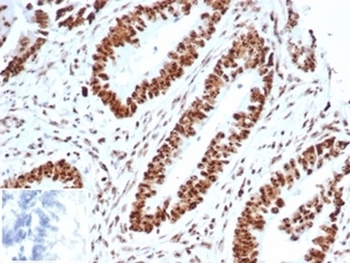 Recombinant Wilms Tumor 1 Antibody / WT1