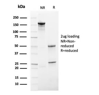 Recombinant HSV1 Antibody / Herpes Simplex Virus Type I