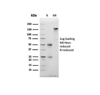 Recombinant Albumin Antibody