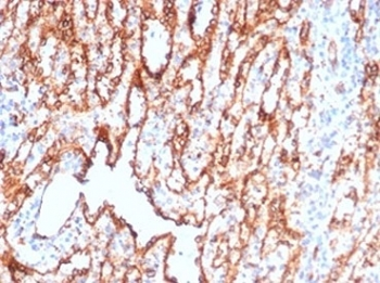 CD36 Antibody