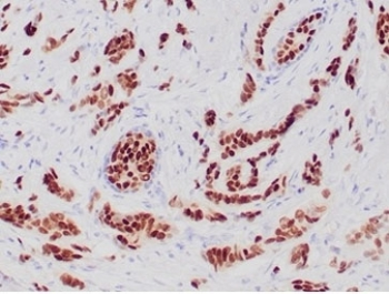 Recombinant Progesterone Receptor Antibody