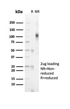 Recombinant Progesterone Receptor Antibody