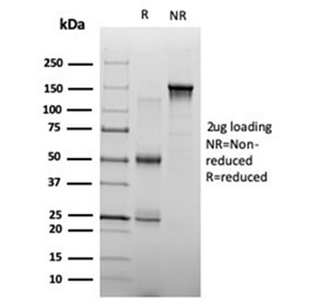 ZHX3 Antibody
