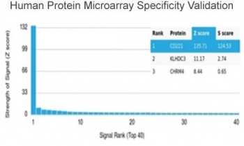 IGF1R Antibody / Insulin like growth factor 1 receptor