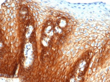 CD44 Antibody / HCAM