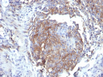 CD44 Antibody / HCAM