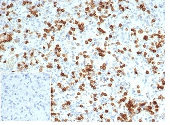 Recombinant CD6 Antibody