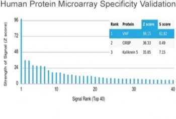 von Willebrand Factor Antibody / vWF