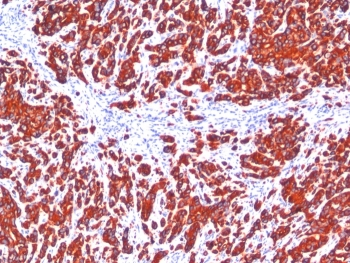 Pan Cytokeratin Antibody Cocktail (Acidic + Basic)