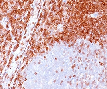 Bcl-2 Antibody