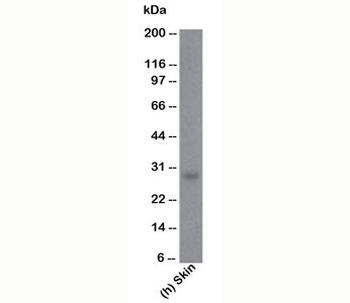 Bcl-2 Antibody