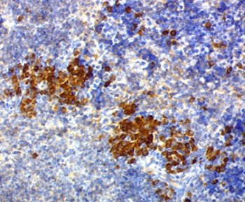 CD63 Antibody / LAMP-3