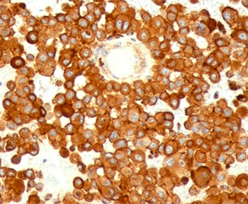 CD63 Antibody / LAMP-3