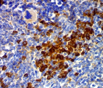 CD63 Antibody / LAMP-3