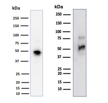 CD79a Antibody