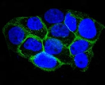 EGFR Antibody