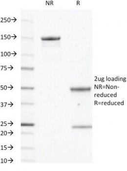 EGFR Antibody
