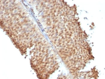 Estrogen Receptor beta Antibody