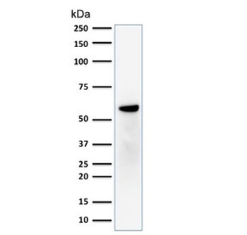 Estrogen Receptor beta Antibody