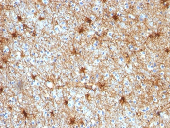 GFAP Antibody