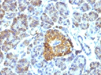 HSP60 Antibody / HSPD1