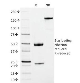IgM Heavy Chain Antibody
