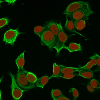 Cytokeratin 8 Antibody